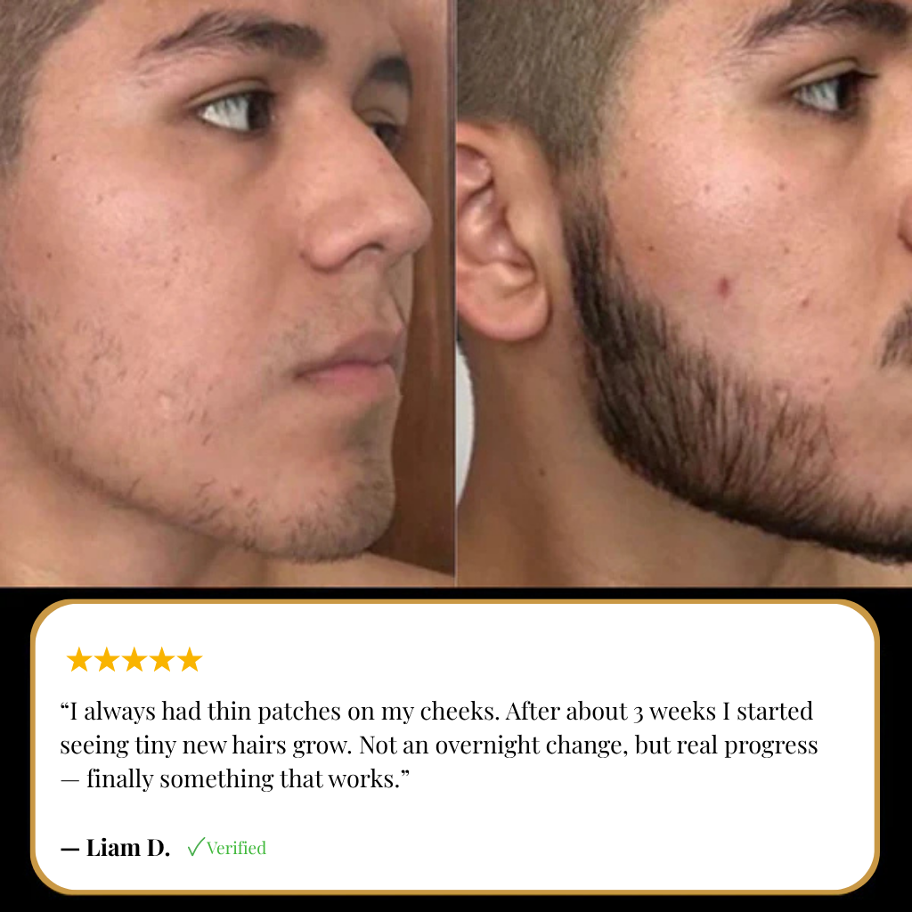 Beard growth oil